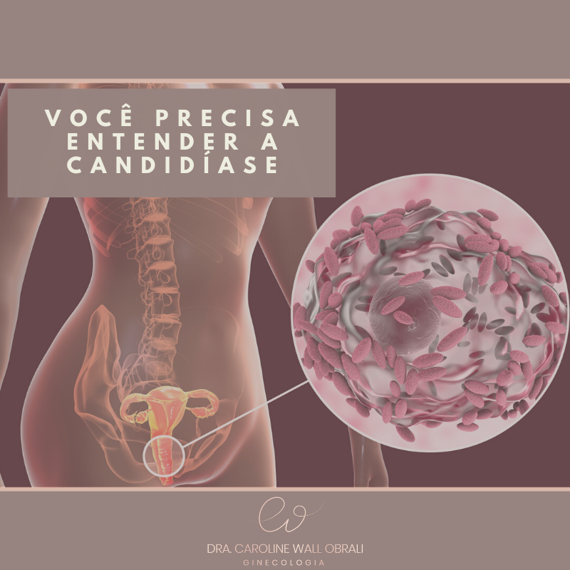 Candidíase: o que é, tipos, sintomas e tratamento - Toda Matéria